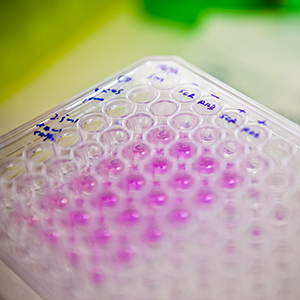 Antibodies