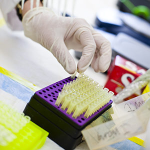 SARS-CoV-2 antigens & serological assay