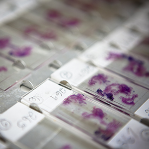 Novel Short Lipopeptides