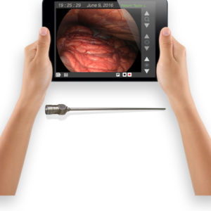 Portable laparoscope