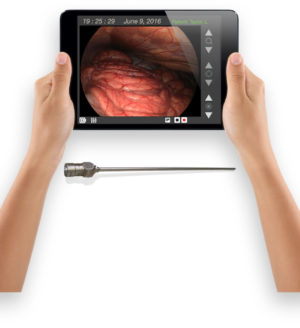 Portable laparoscope