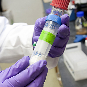 Nanogel cancer treatment