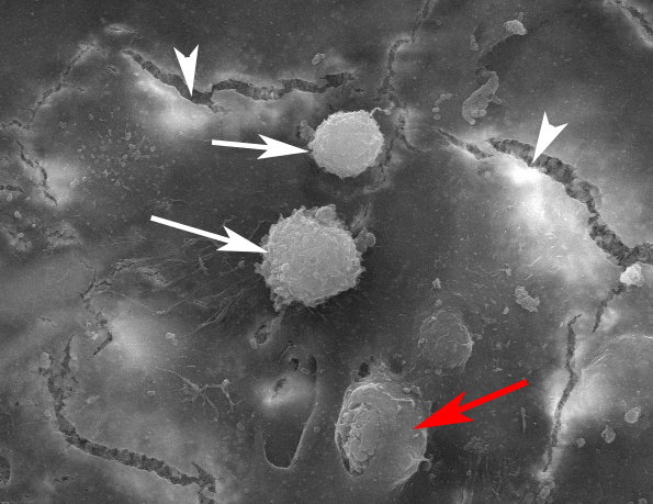 Gap junction between the endothelial cells (arrow heads) were identified under scanning electron microscope. Monocytes bond to endothelial cells at gap junction area (white arrows). Monocyte migrated into and underneath the endothelial cell layer (red arrow).